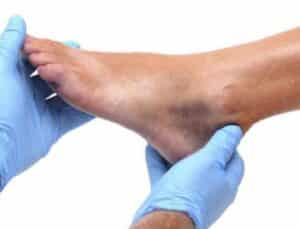ayak bileği yaralanmaları neden olur? tedavi yöntemleri nelerdir?